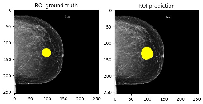 Domain adaptation in digital mammography image processing's cover