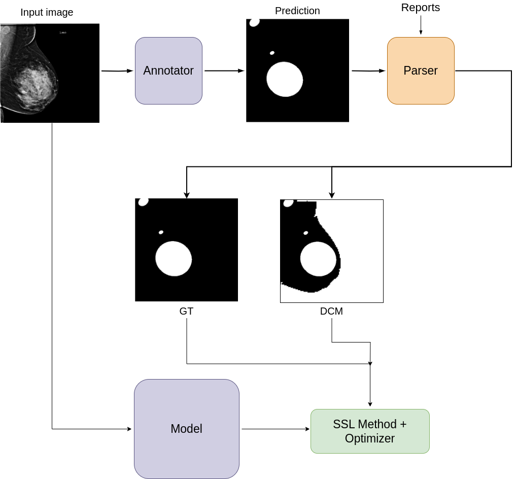 Enhancing Injury Segmentation in Breast Mammograms Through Semi-Supervised Learning's cover